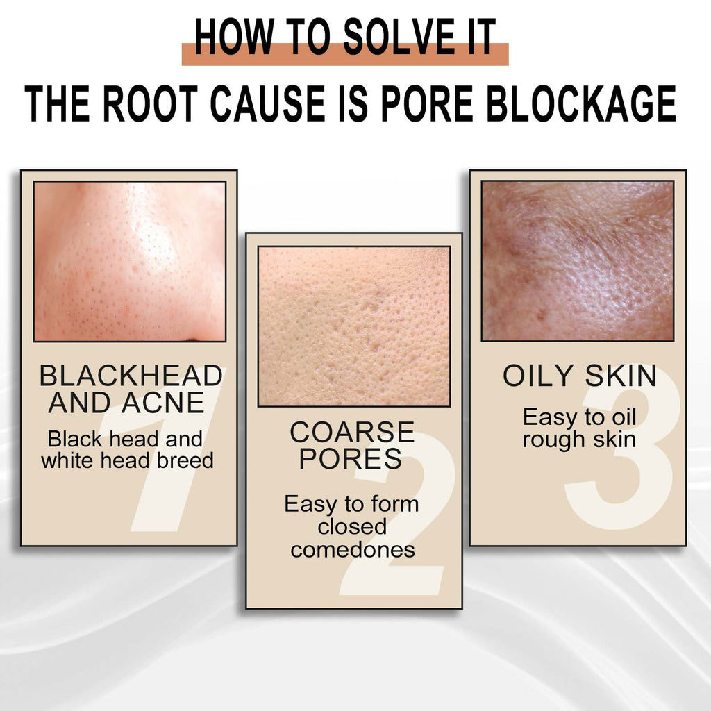 Lactobacillus Exfoliating & Pore-Refining Essence