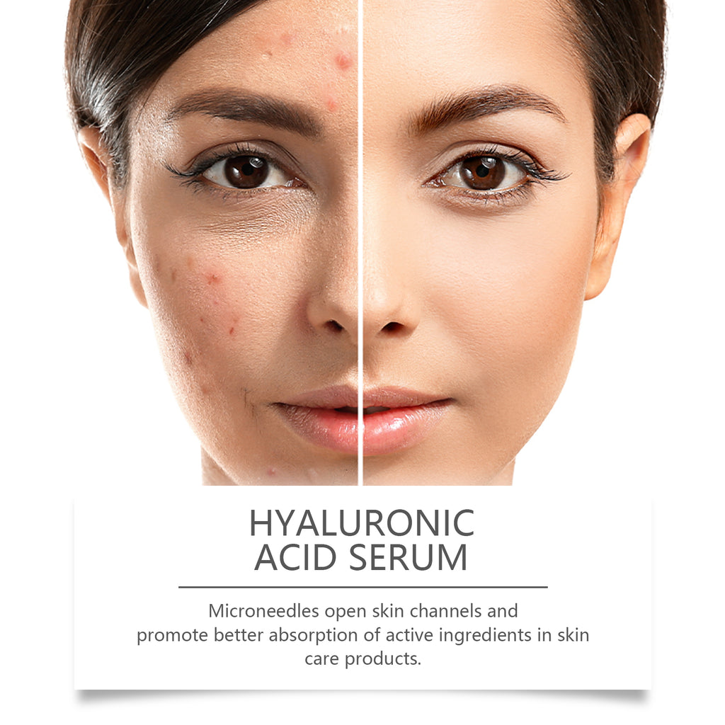 Hyaluronic Acid Radiance Face Serum